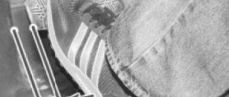 Регулировка привода сцепления